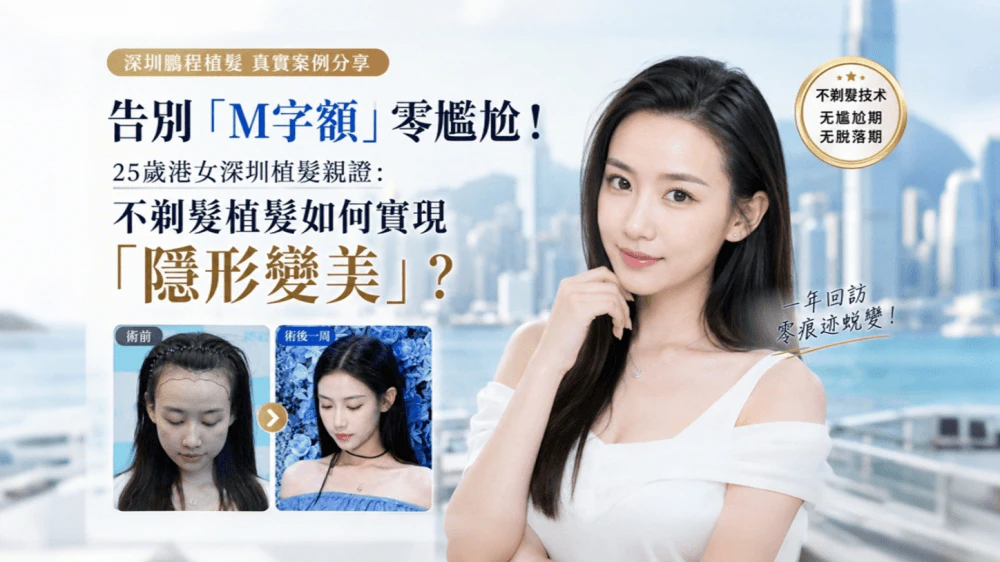 告別「M字額」零尷尬！25歲港女深圳植髪親證：不剃髮植髮如何實現「隱形變美」？